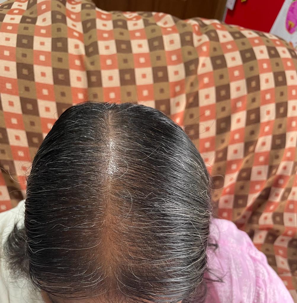 Mrs. Krishna Priya - Bangalore — result after using Vaarshieka