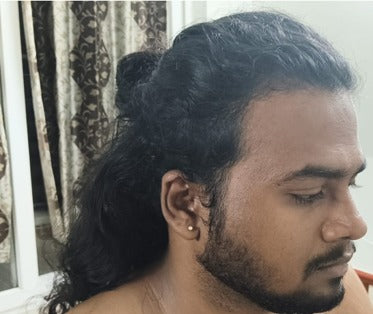 Mr. Akash - Chennai — result after using Vaarshieka