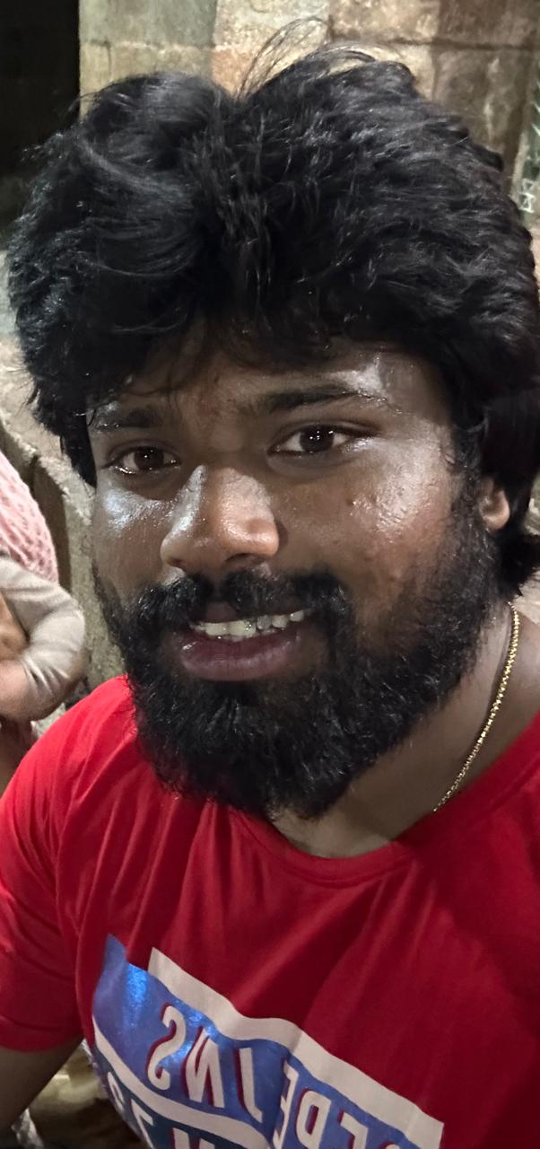 Mr. Karthick - Trichy — before using Vaarshieka